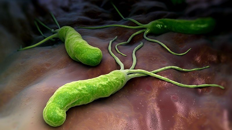 H pylori Infection Linked With Increased Alzheimer's Risk
