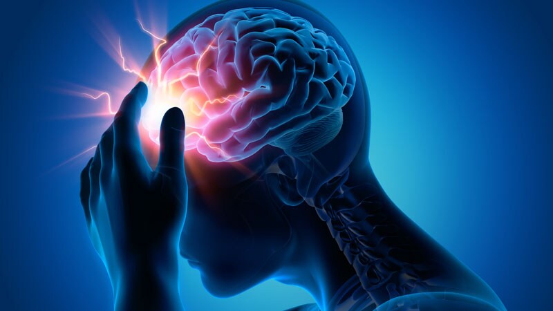 Will Imaging Improve Migraine Diagnosis and Management?