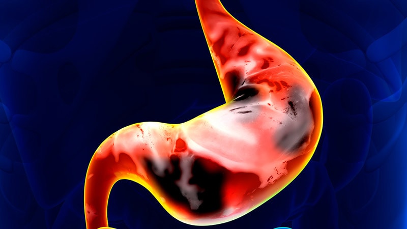 Gastric Cancer Survival Differs by Race and Ethnicity